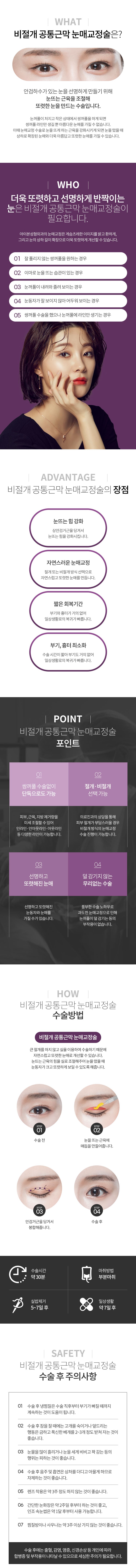 눈매교정술